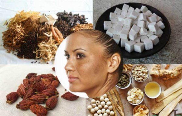 Sự thật về chữa nám bằng thuốc đông y trôi nổi hiện nay