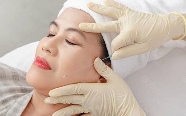 Tác dụng phụ của căng da mặt bằng chỉ