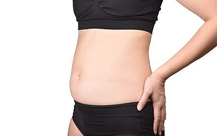 Ốm nhưng có mỡ bụng: Nguyên nhân và cách cải thiện hiệu quả